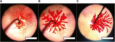 Extensive tip-splitting of injected organic liquid into an aqueous viscoelastic fluid